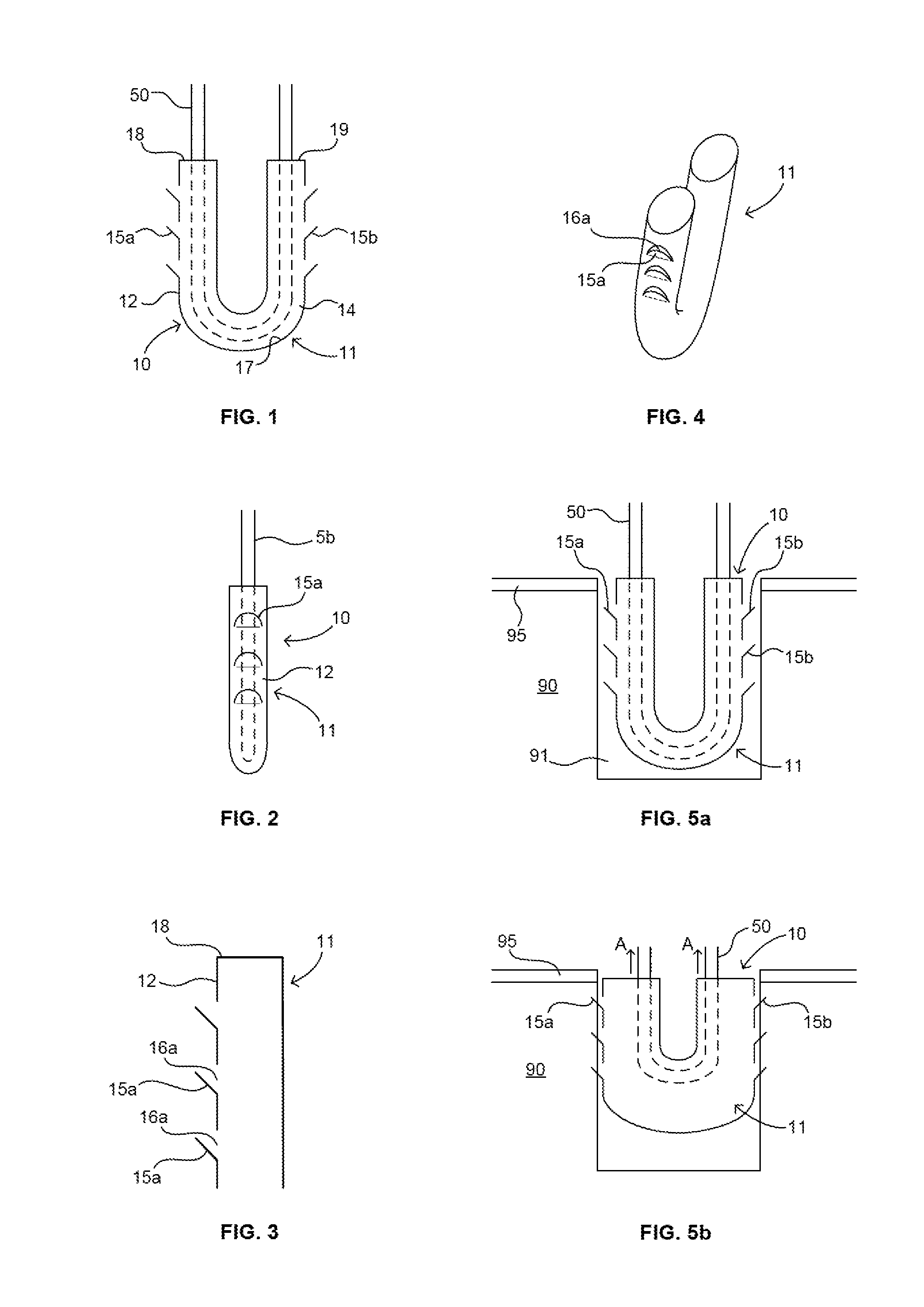 Filamentary fixation device having projections and method of use