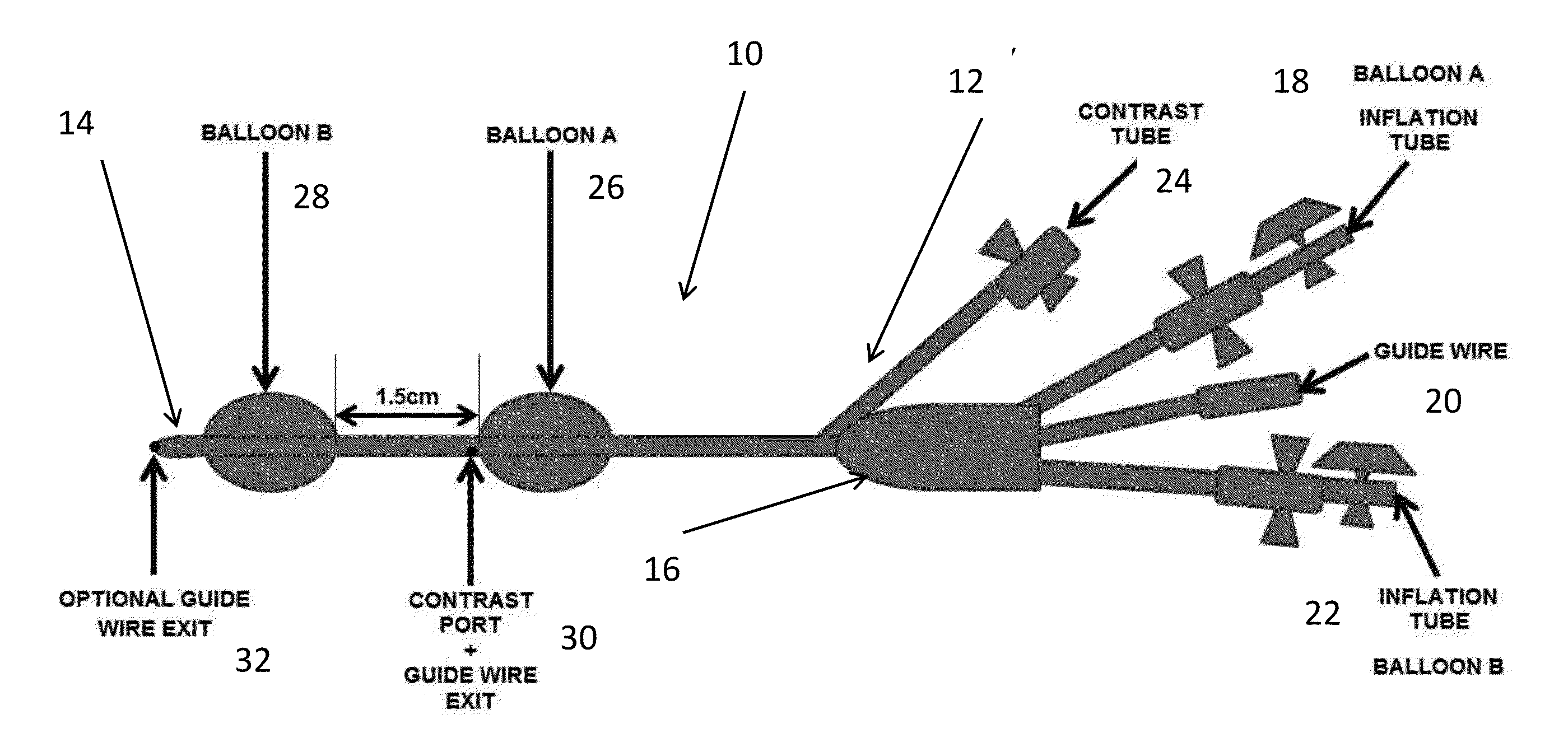 Dual Balloon Biliary Stone Extraction Device