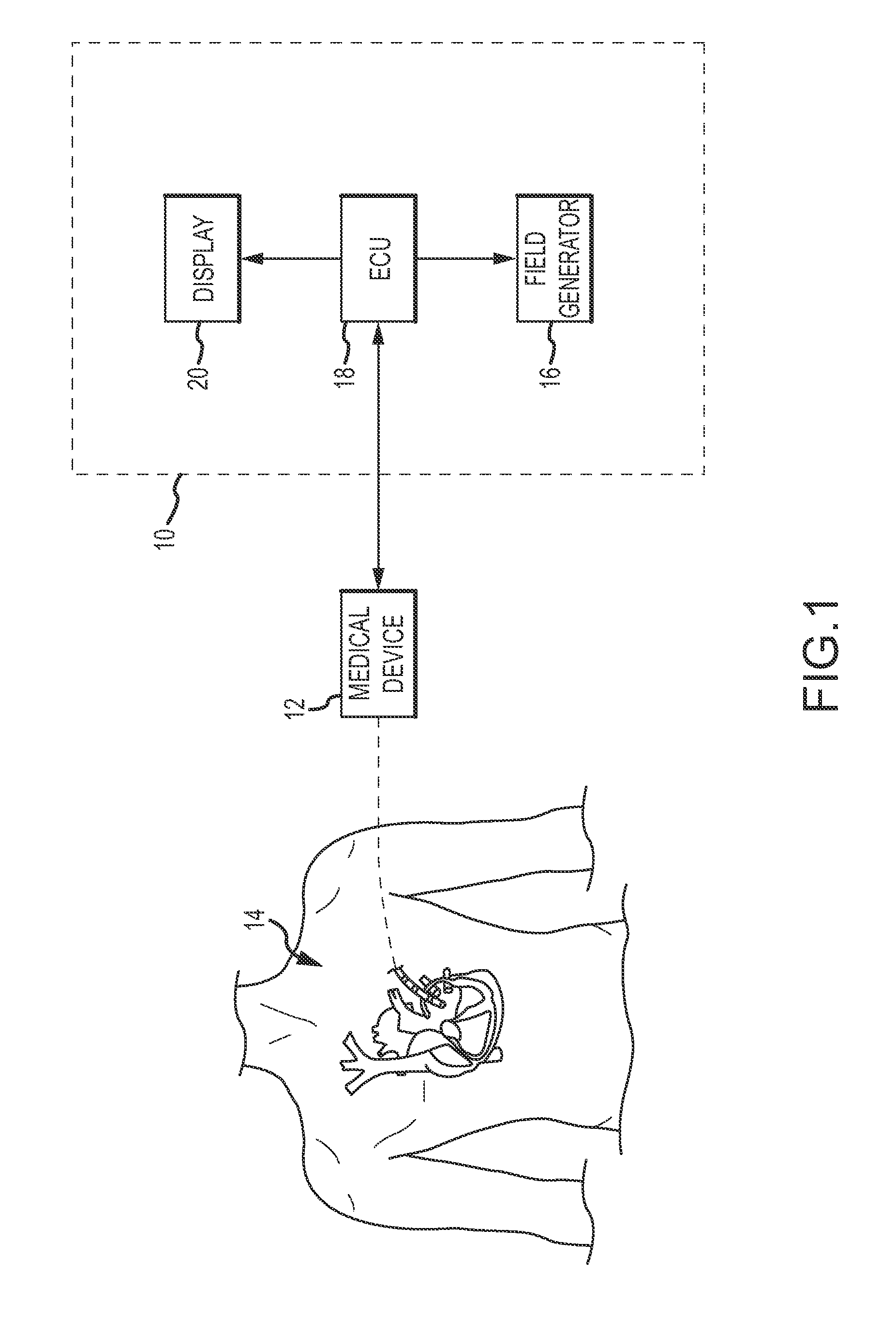 Reducing mechanical stress on conductors and connection points in a position determinable interventional medical device