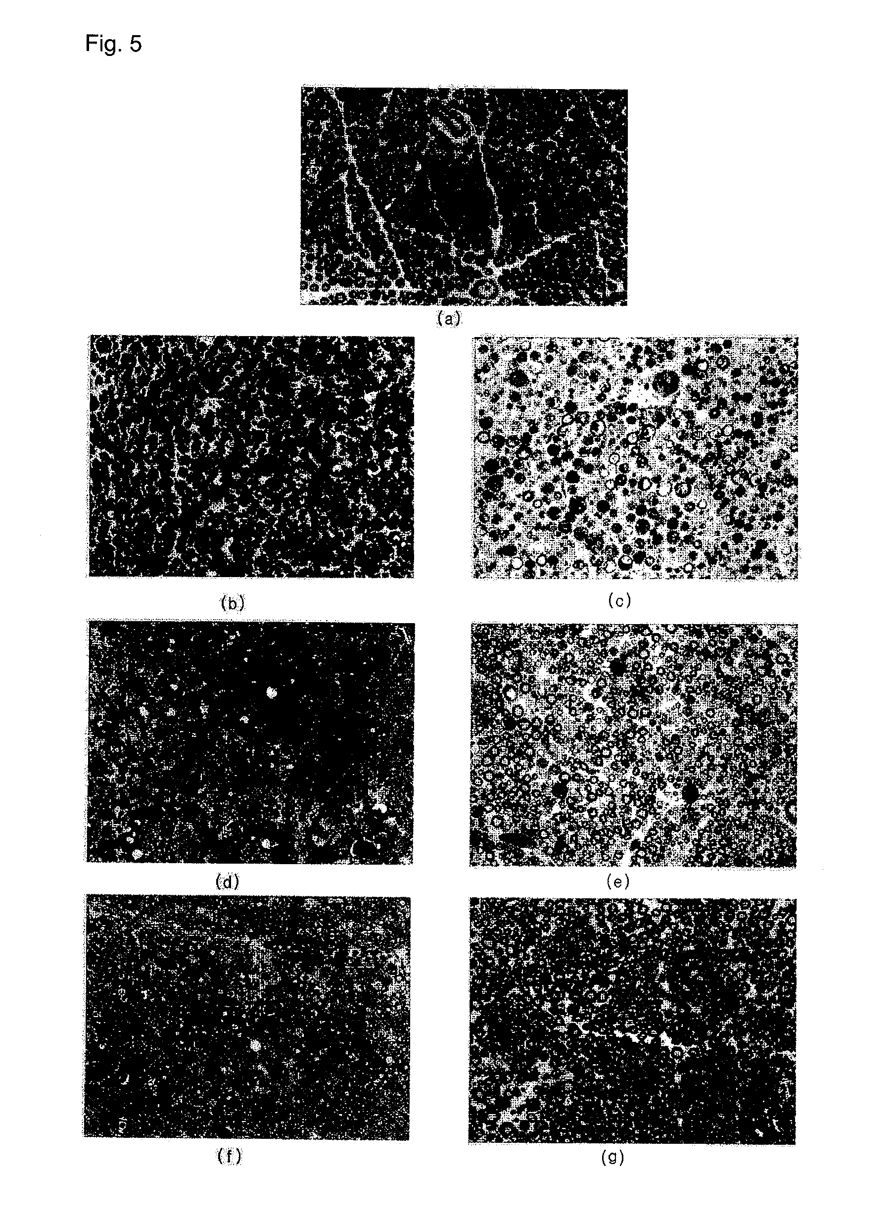 Pharmaceutical composition for preventing or treating neuronal damage and neurological diseases