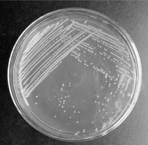 A Strain of Pseudomonas and Its Application