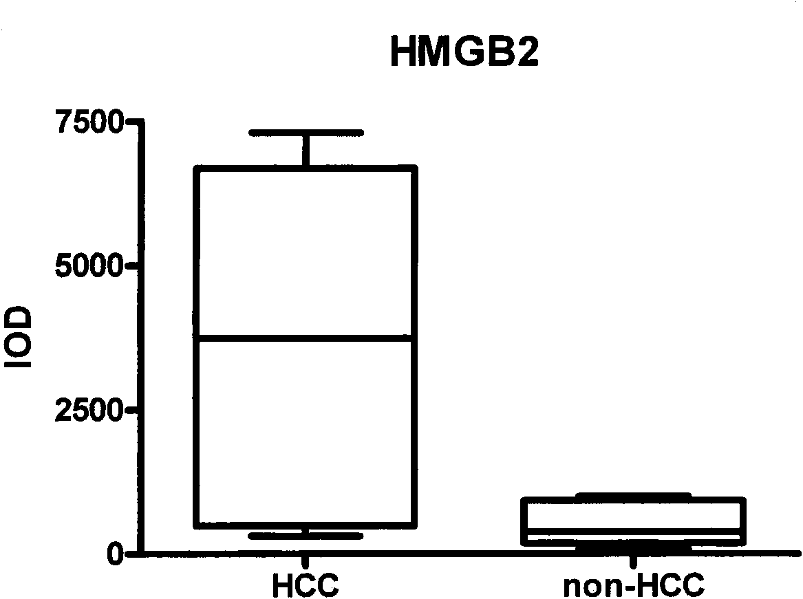 Application of high mobility group protein B2 as liver cell carcinoma marker