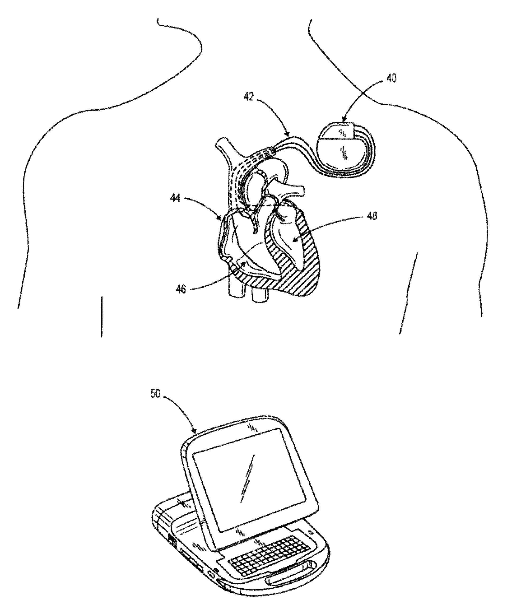 Method of defining continuous heart rate vs AV delay values and sensed to paced AV delay offset in patients undergoing cardiac resynchronization therapy