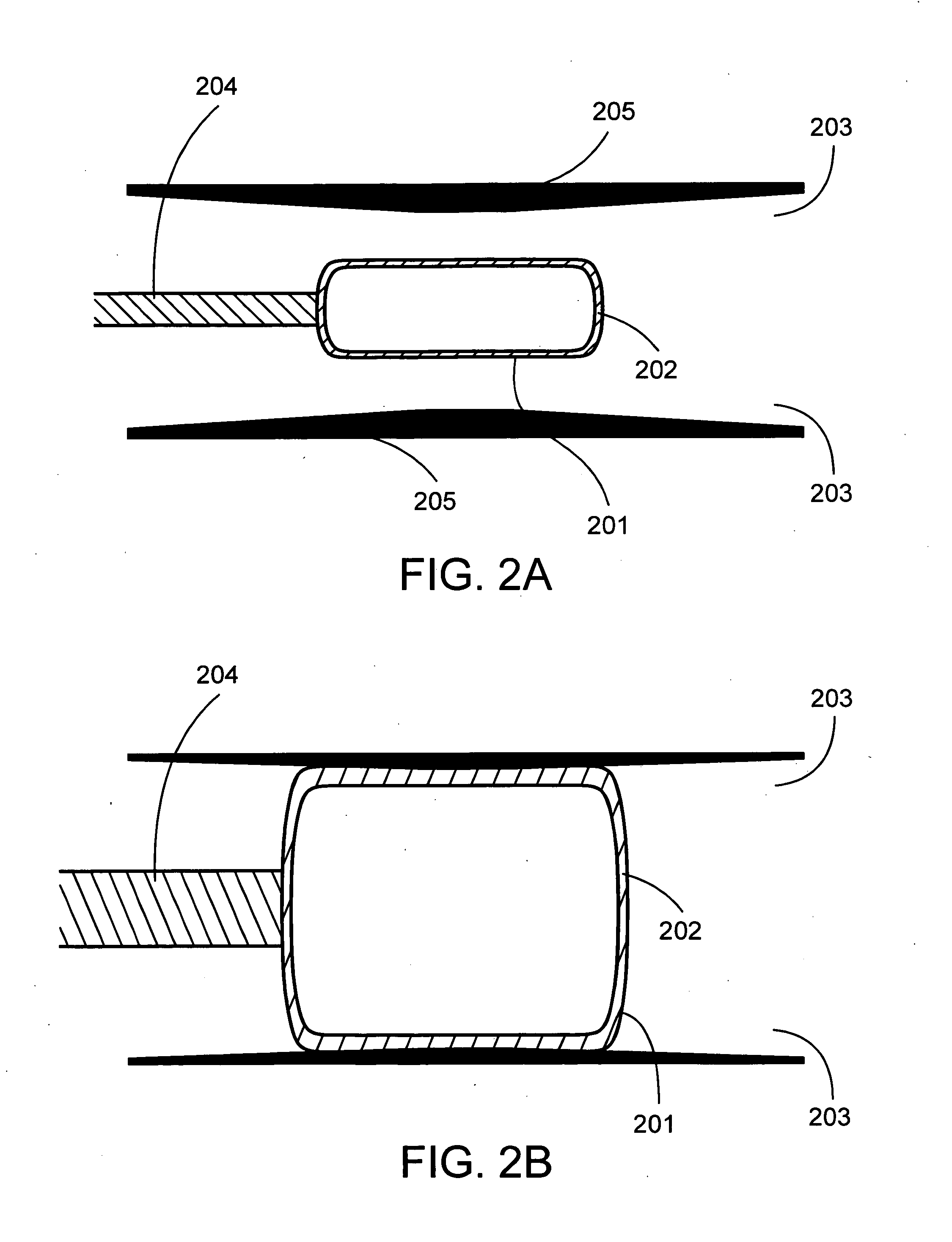 Expandable medical devices with reinforced elastomeric members and methods employing the same