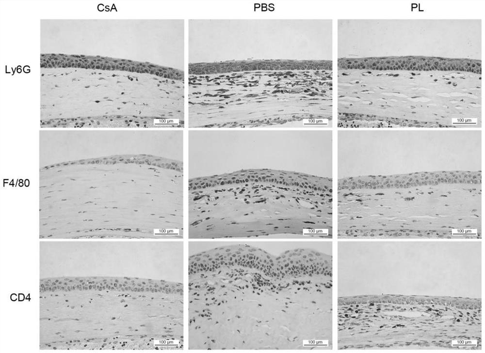 Application of piperlongumine in preparation of medicine for preventing and treating immunological rejection in corneal transplantation