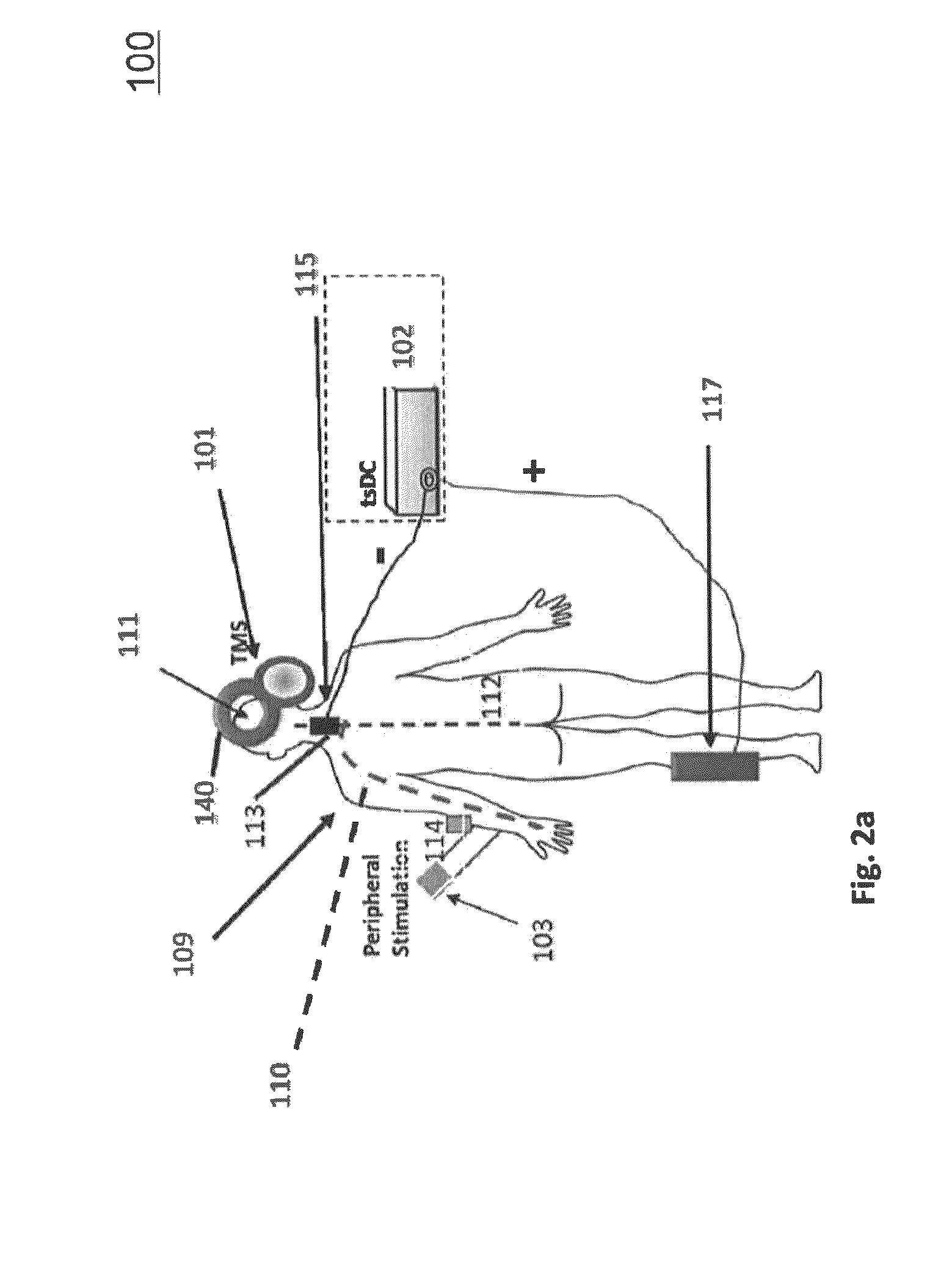 Method and system for treatment of neuromotor dysfunction