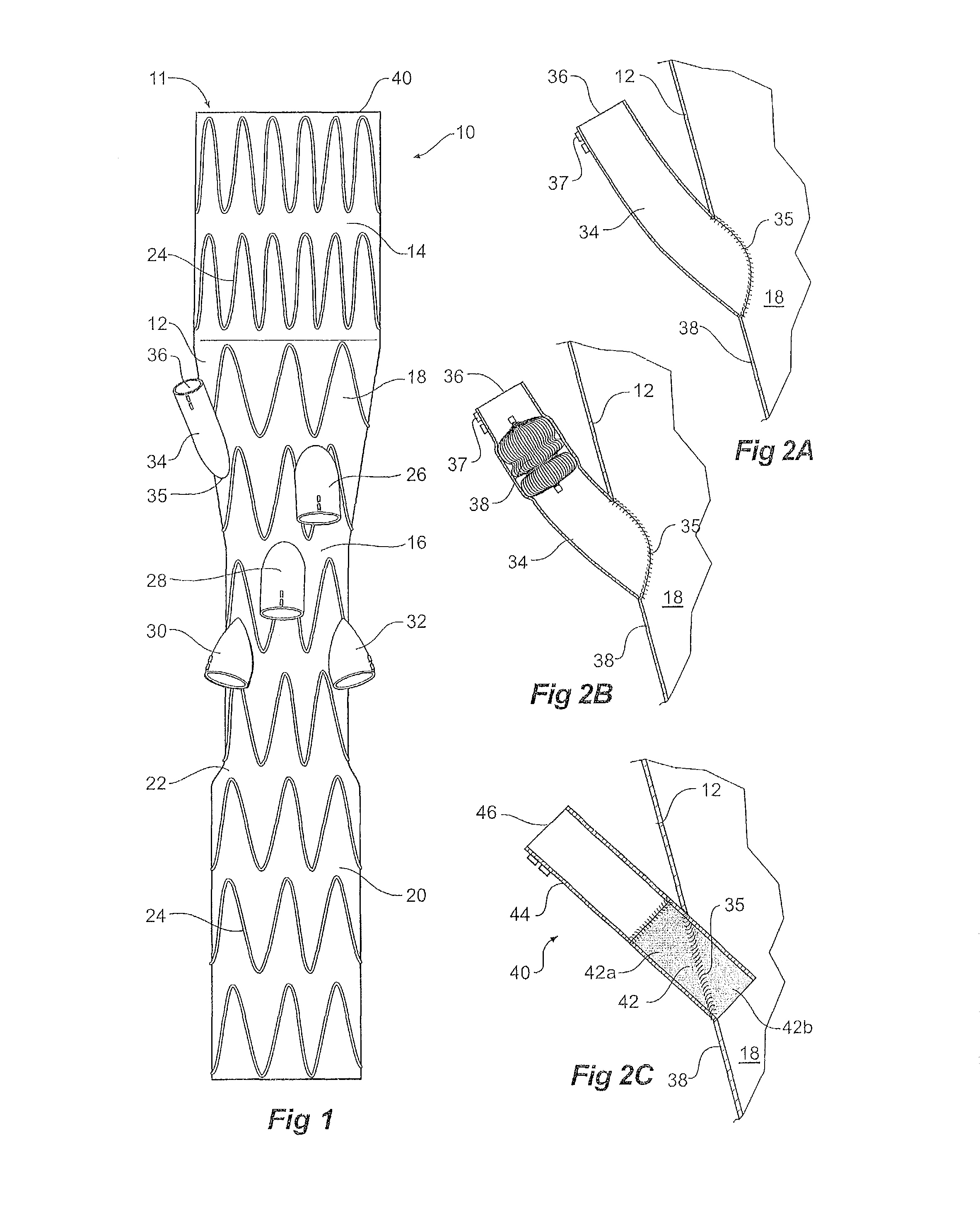 Paraplegia prevention stent graft