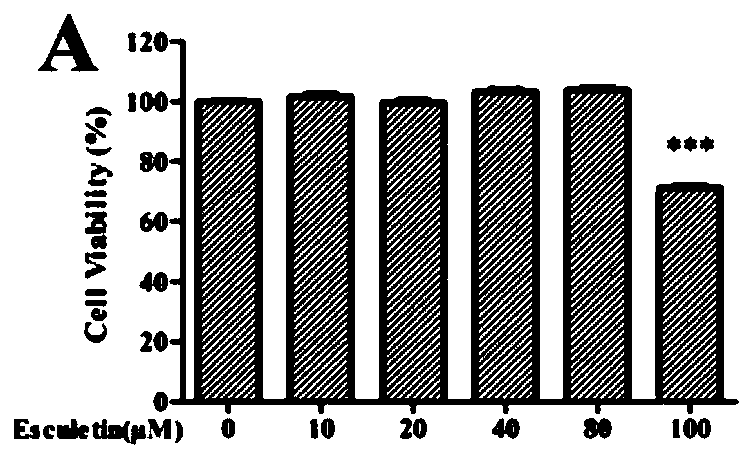 Application of teretin B in the preparation of medicines or health products for the treatment and prevention of eye diseases