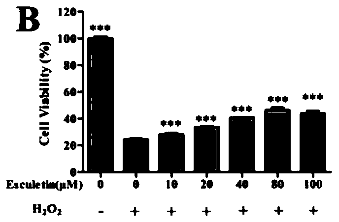 Application of teretin B in the preparation of medicines or health products for the treatment and prevention of eye diseases