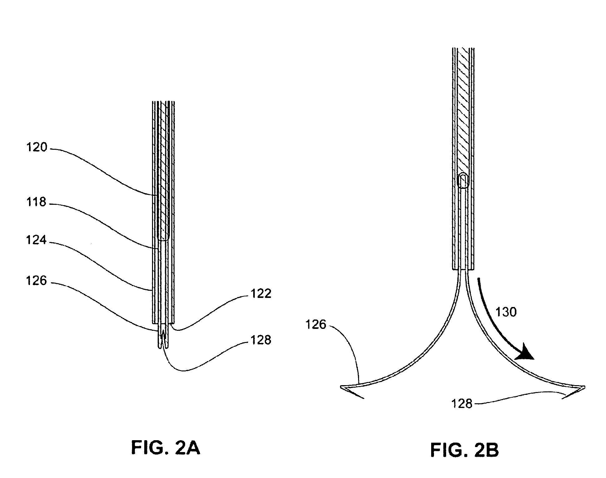 Methods for approximation and fastening of soft tissue