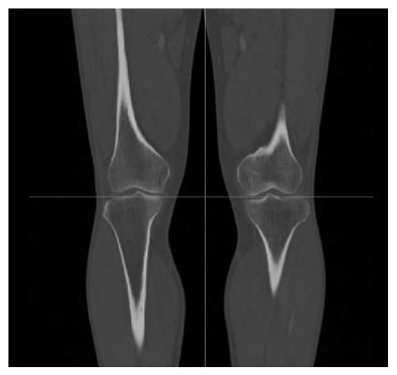 Method for establishing individualized knee joint bionic ligament biomechanical model