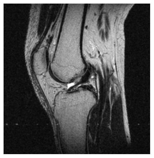 Method for establishing individualized knee joint bionic ligament biomechanical model