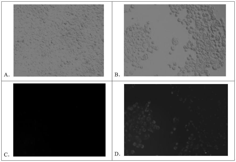Recombinant adenovirus with anti-tumor immune function as well as preparation method and application of recombinant adenovirus