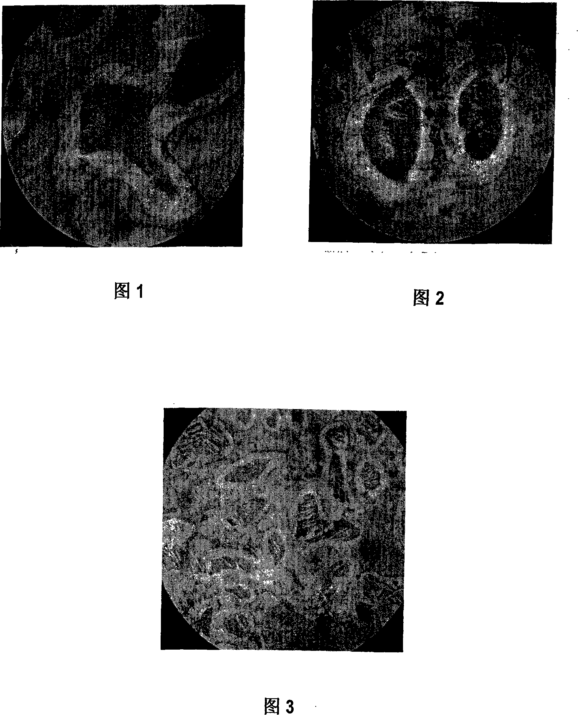 Method for reclaiming valuable element from zinc kiln slag