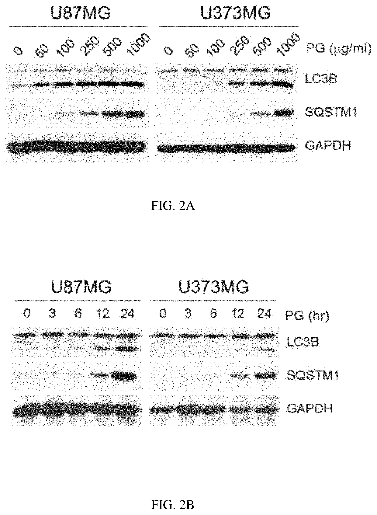 Composition for preventing or treating glioblastoma comprising <i>Platycodon grandiflorum </i>A. De Candolle, <i>Scutellaria baicalensis, Phellodendron amurense </i>Ruprecht or <i>Rubus coreanus </i>