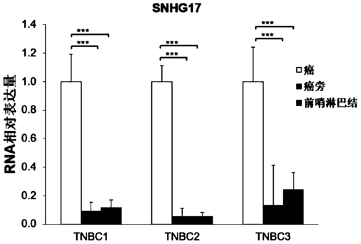 Oligonucleotide targeting SNHG17 for treating breast cancer