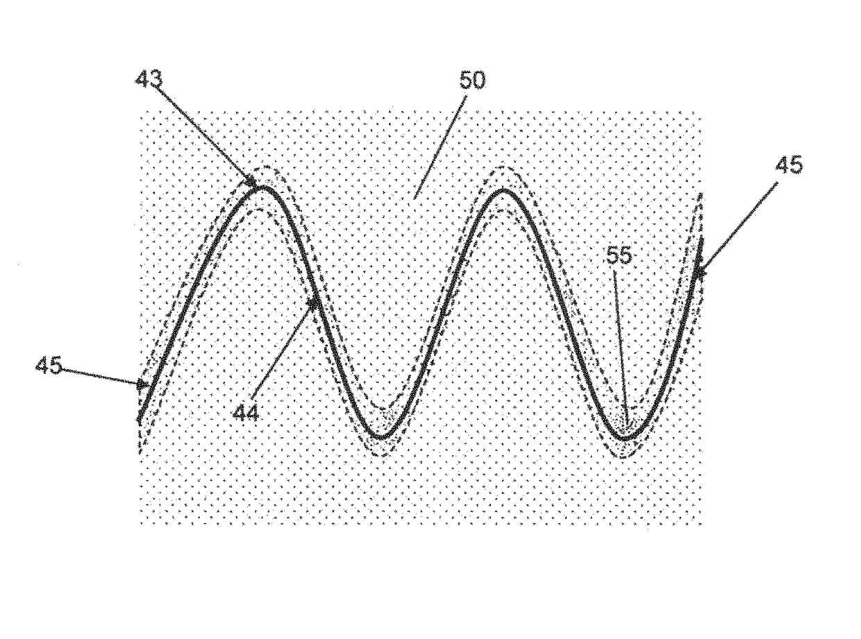 Stent attachment for endovascular aneurysm repair