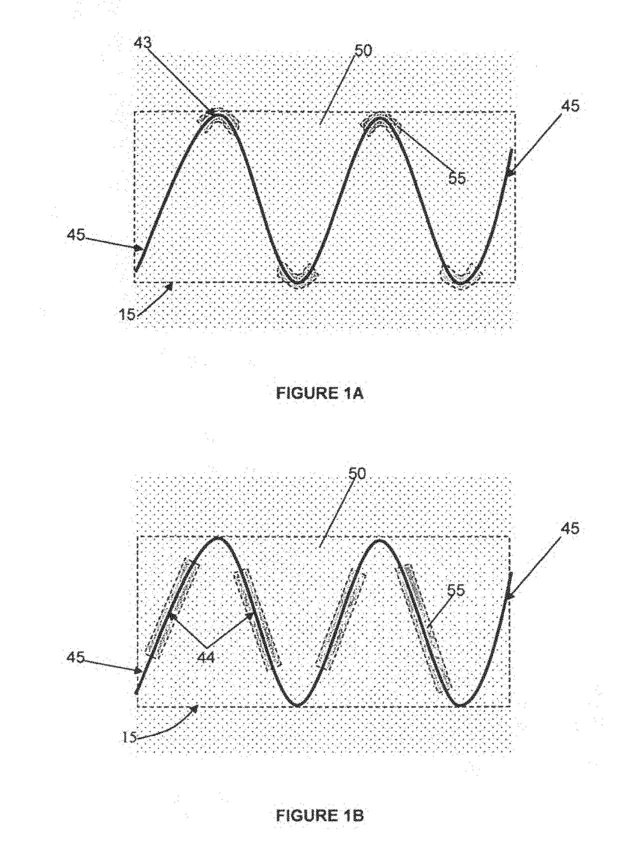 Stent attachment for endovascular aneurysm repair