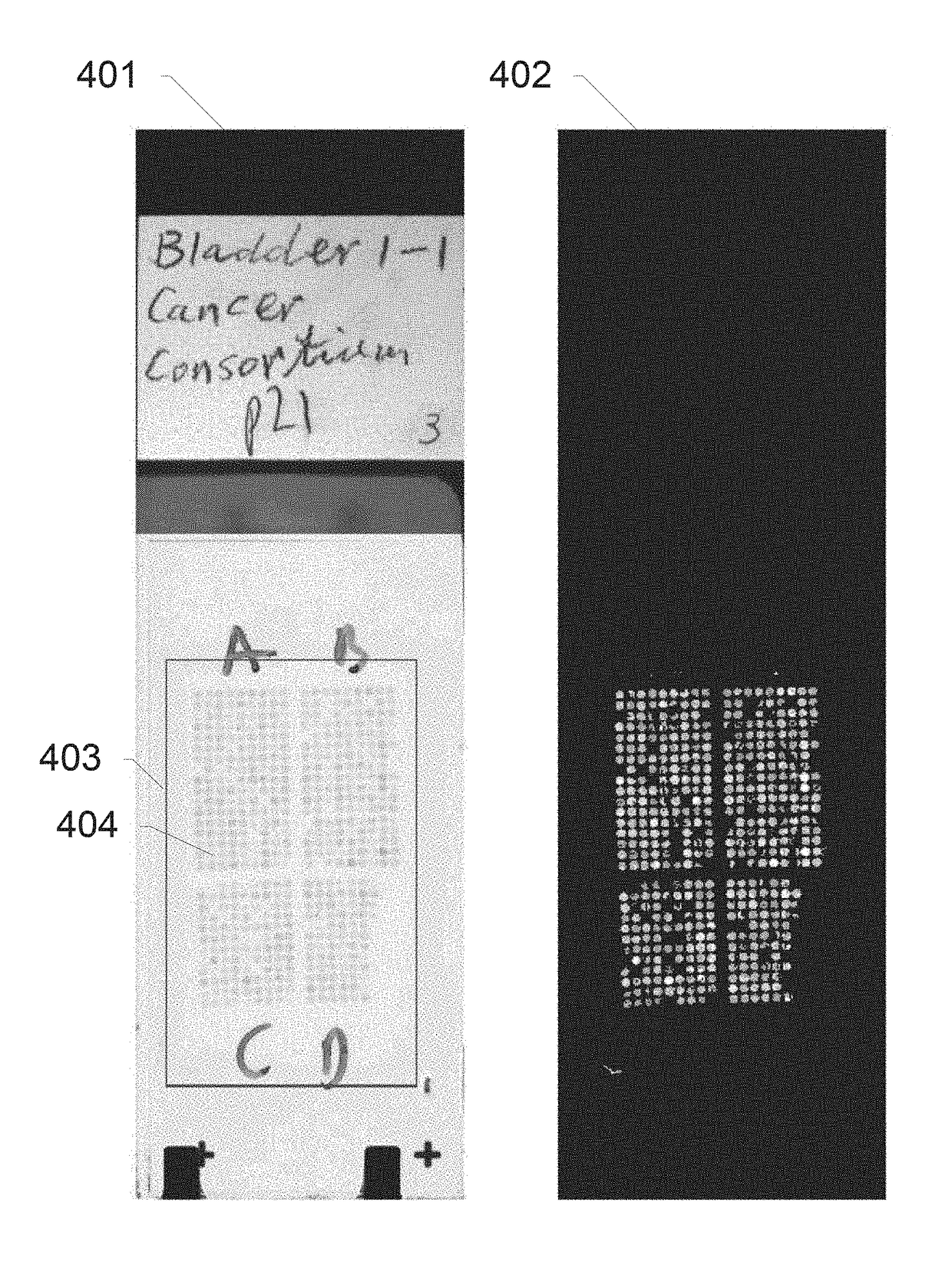 Systems and methods for area-of-interest detection using slide thumbnail images