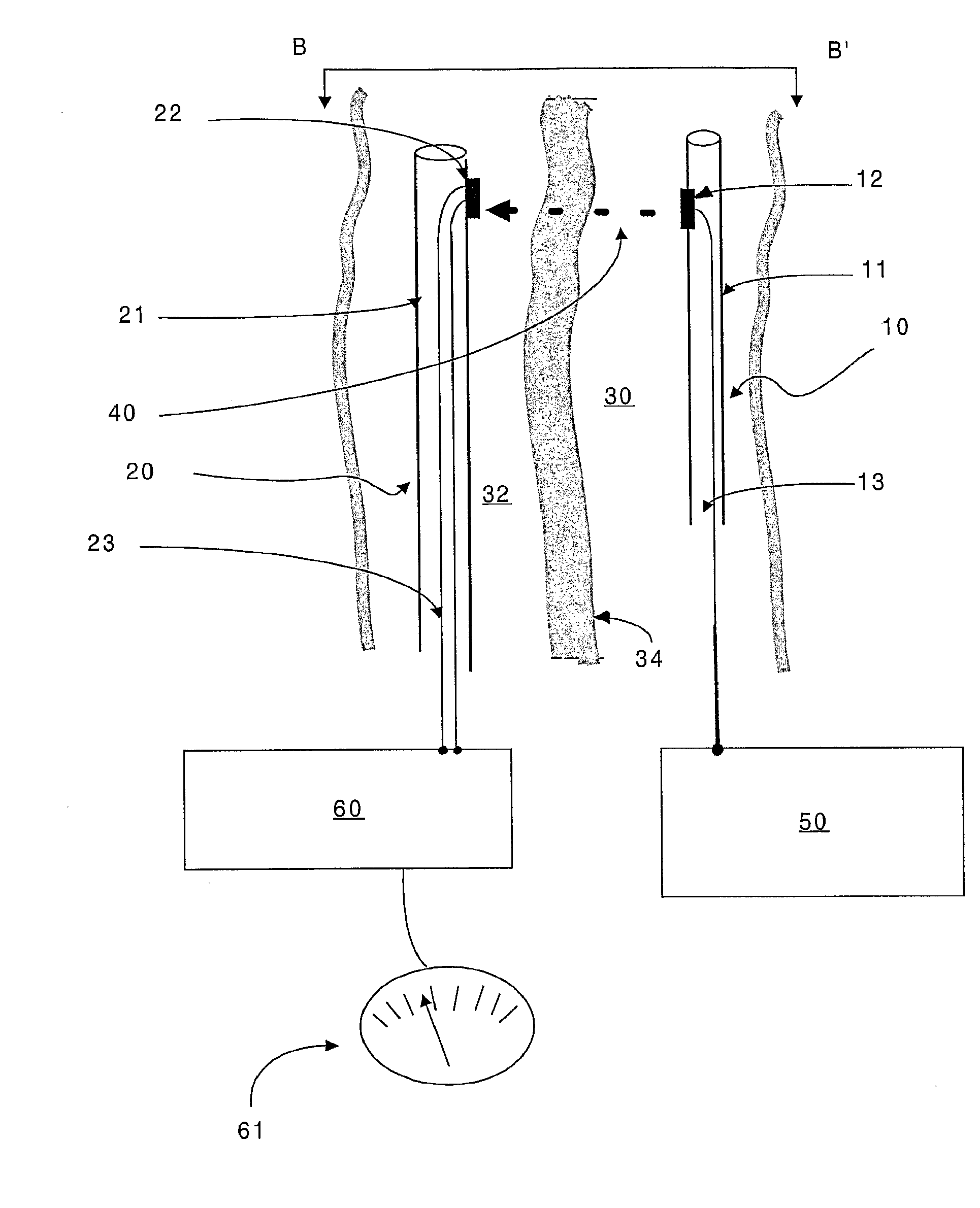 Minimally invasive surgical apparatus and methods