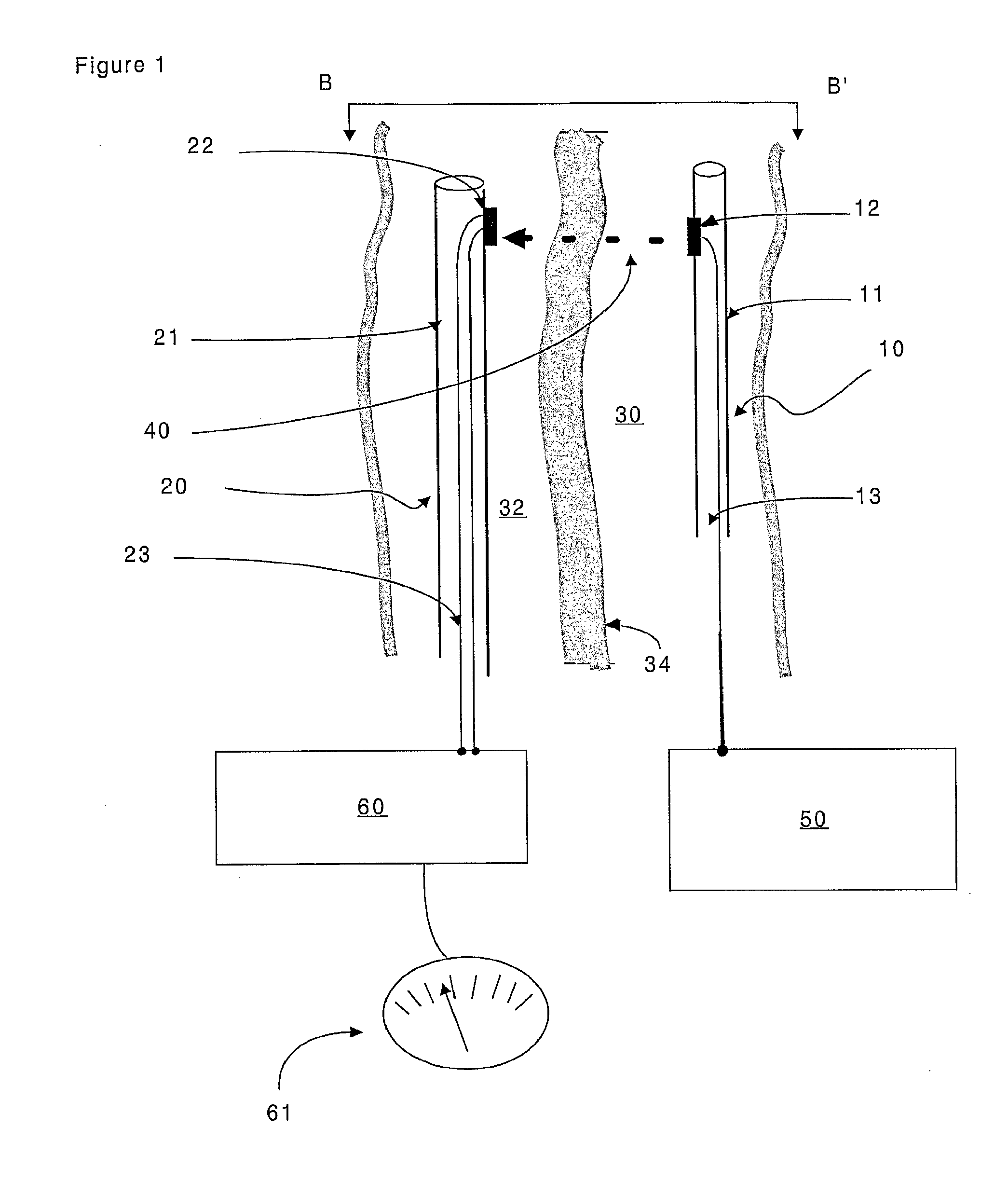 Minimally invasive surgical apparatus and methods