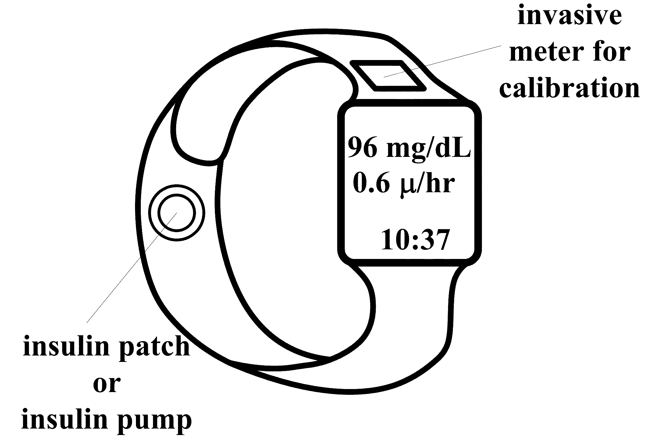 Wearable, noninvasive glucose sensing methods and systems