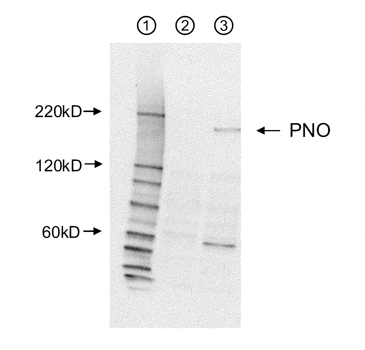 Amino acid producing microorganism and a method for producing an amino acid