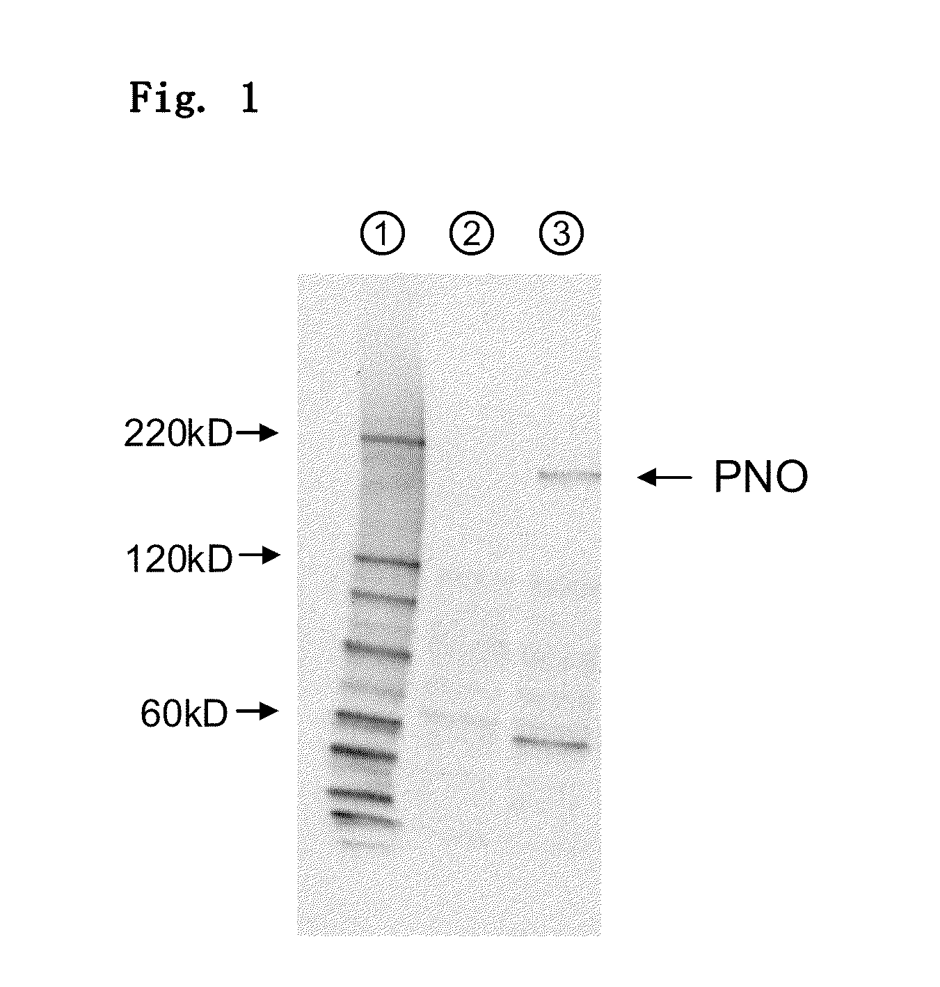 Amino acid producing microorganism and a method for producing an amino acid