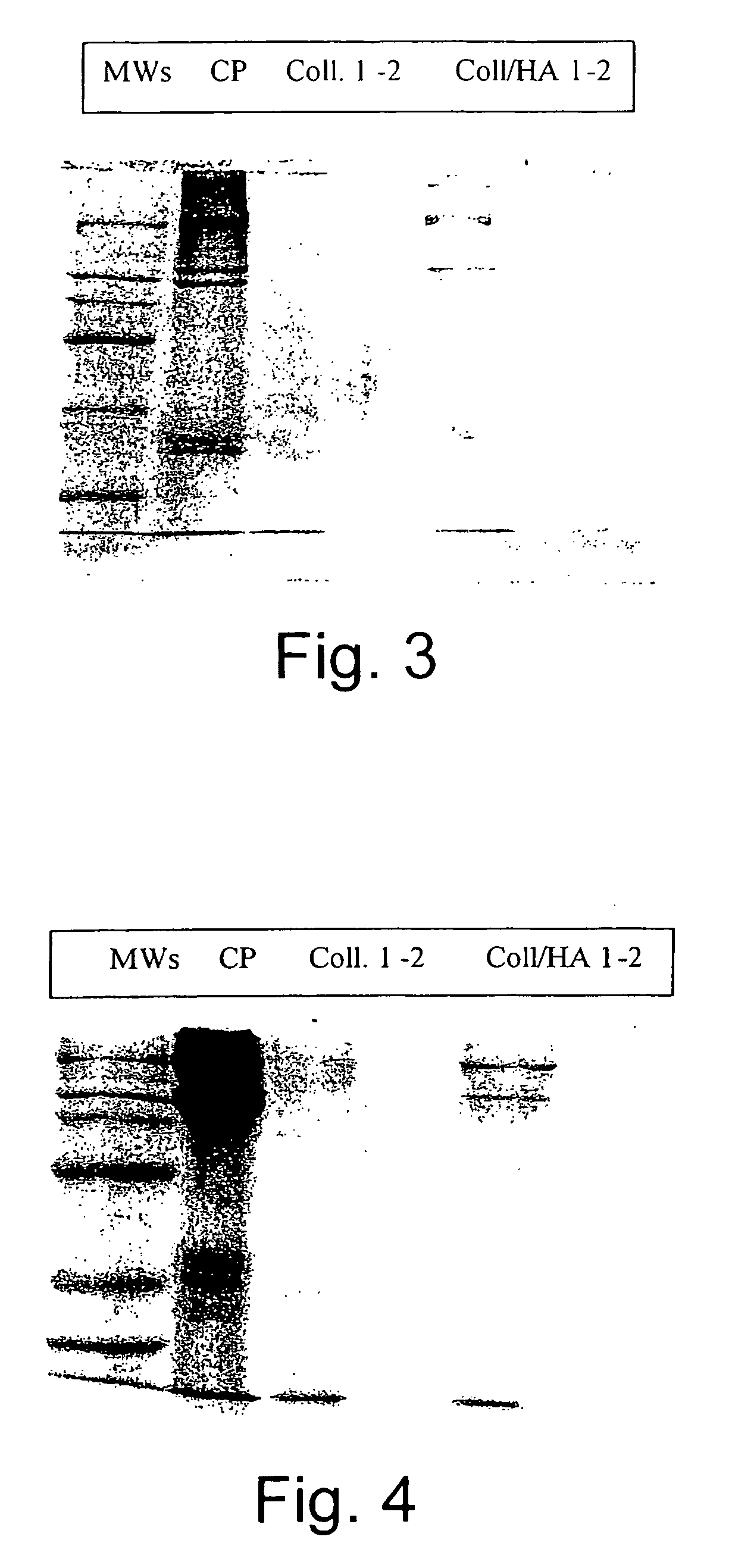 Pharmaceutical compositions containing hyaluronic acid and collagenase for the topical treatment of wounds, burns and ulcers
