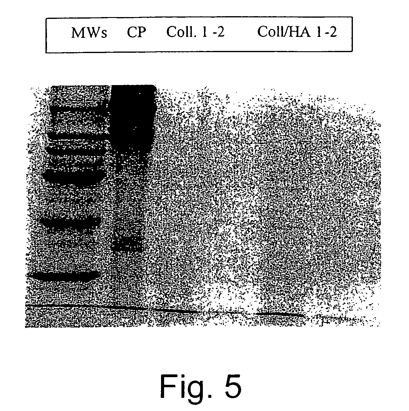 Pharmaceutical compositions containing hyaluronic acid and collagenase for the topical treatment of wounds, burns and ulcers