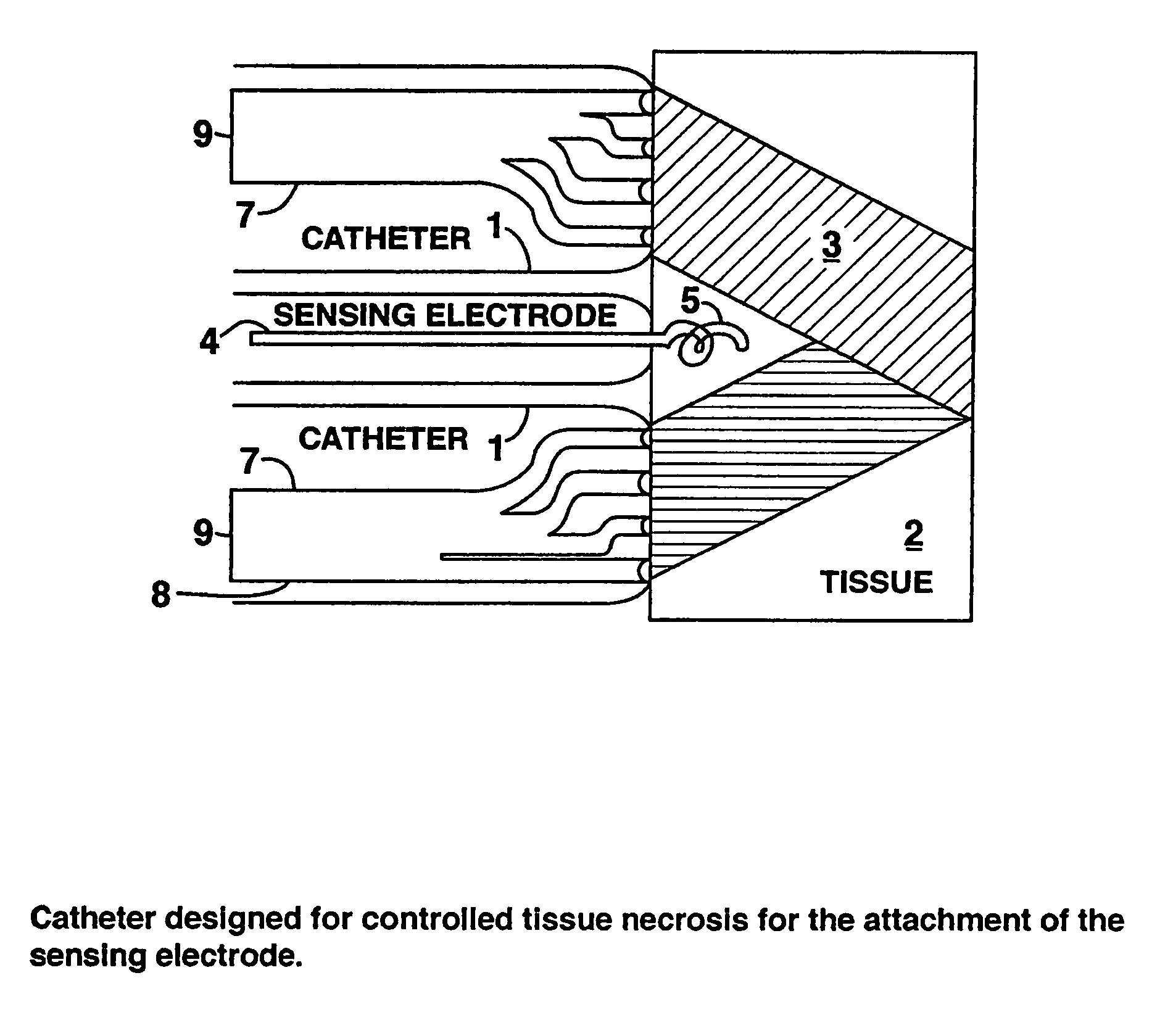 Method and device to form a sensor using isolated cardiomyocytes