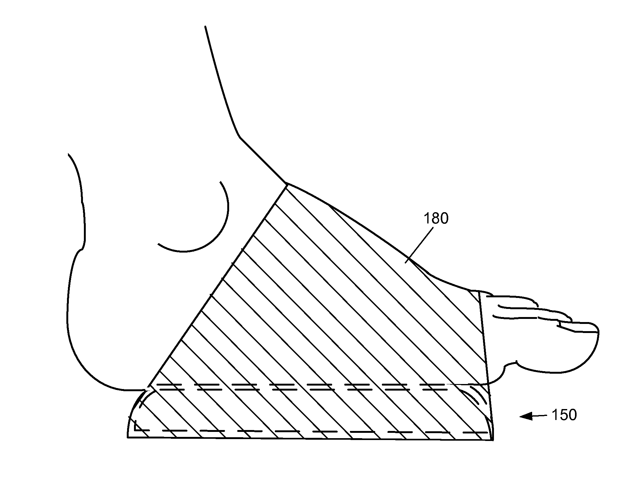 Apparatus for plantar fasciitis treatment and method for making same