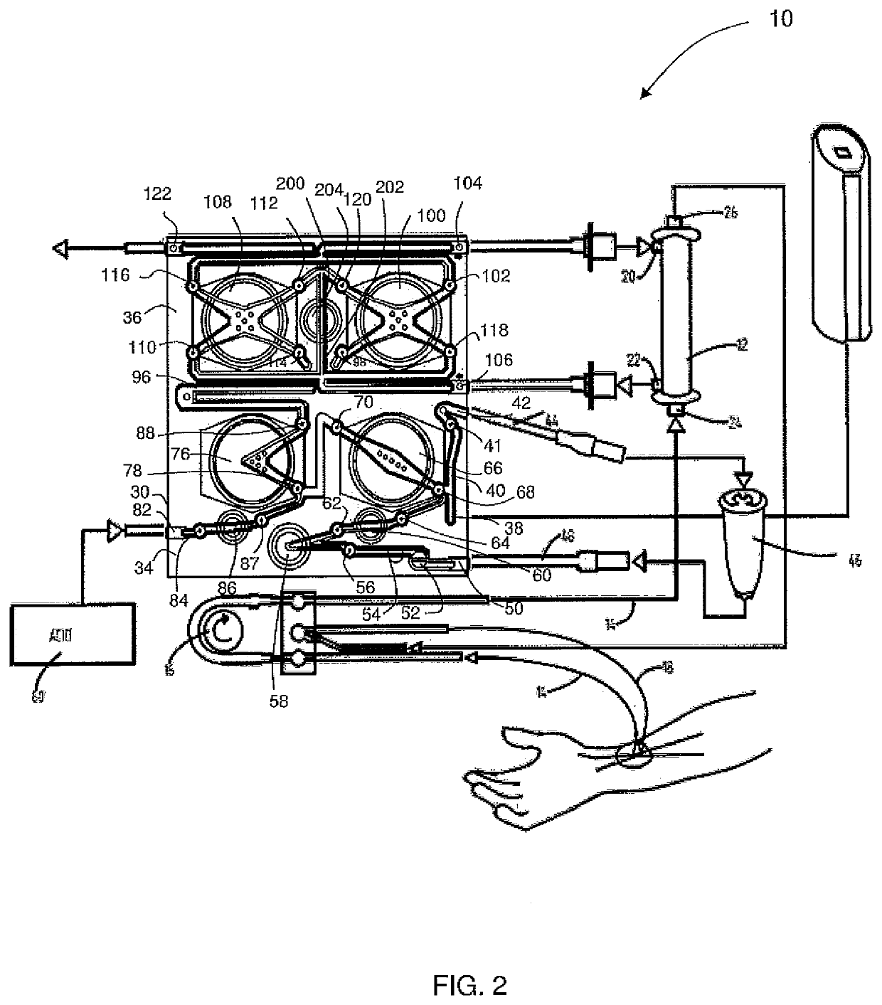 A dialysis machine