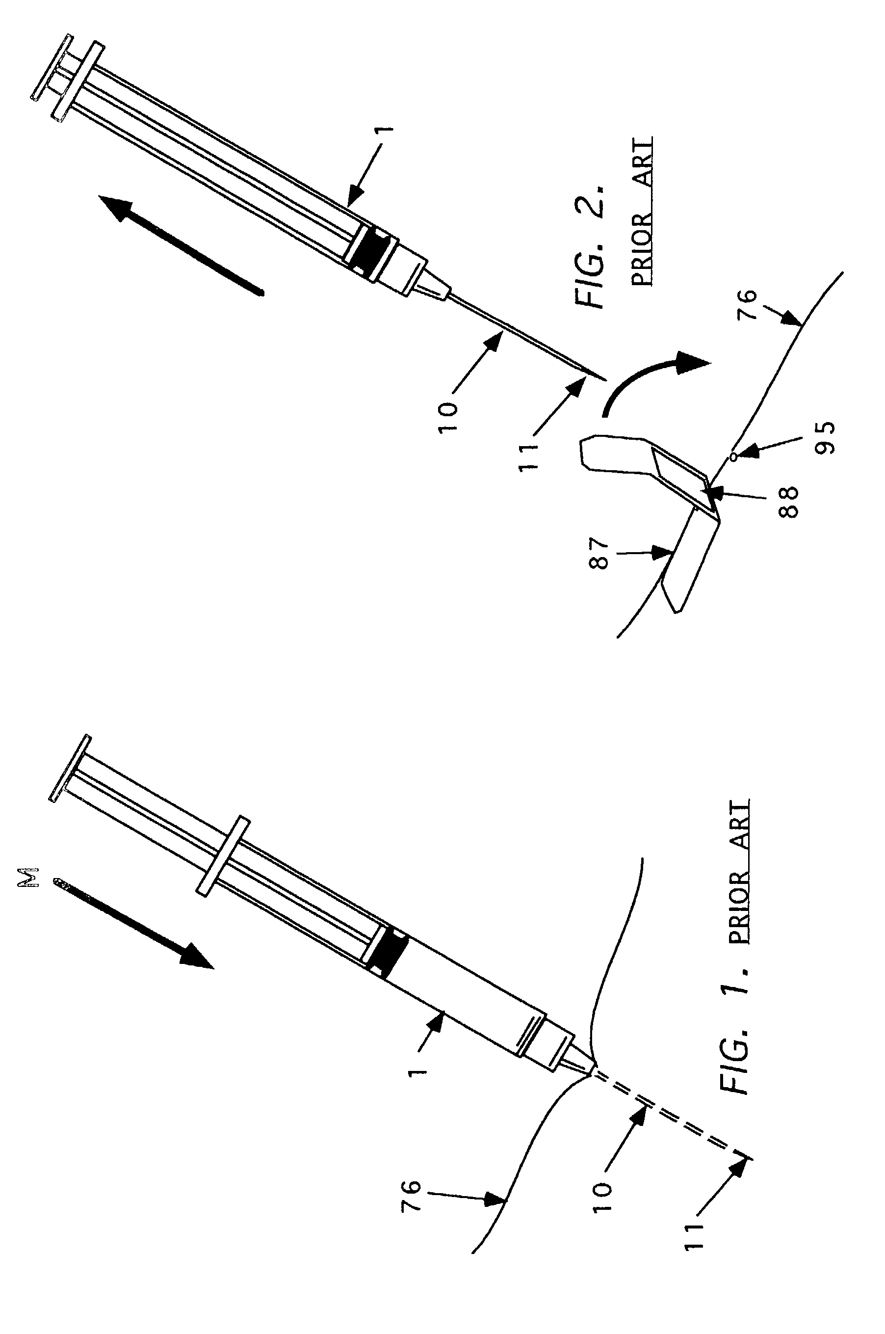 Method and apparatus for indicating or covering a percutaneous puncture site