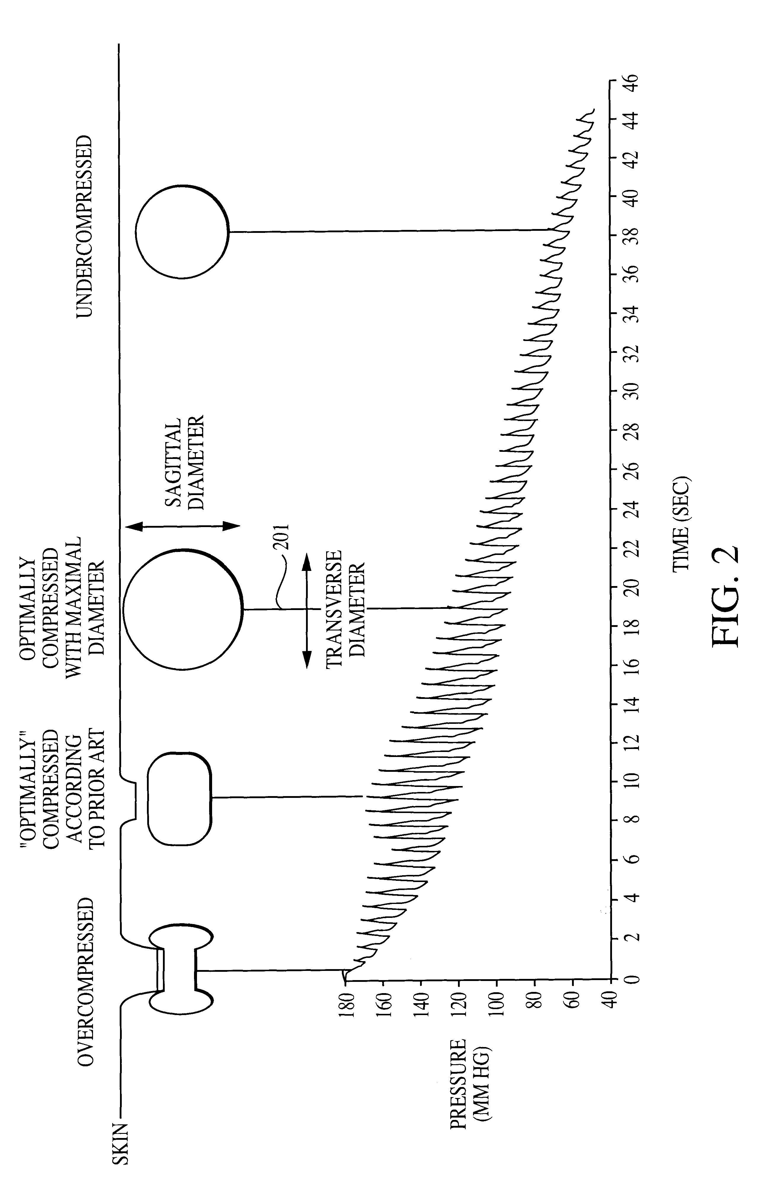 Method and apparatus for the noninvasive determination of arterial blood pressure
