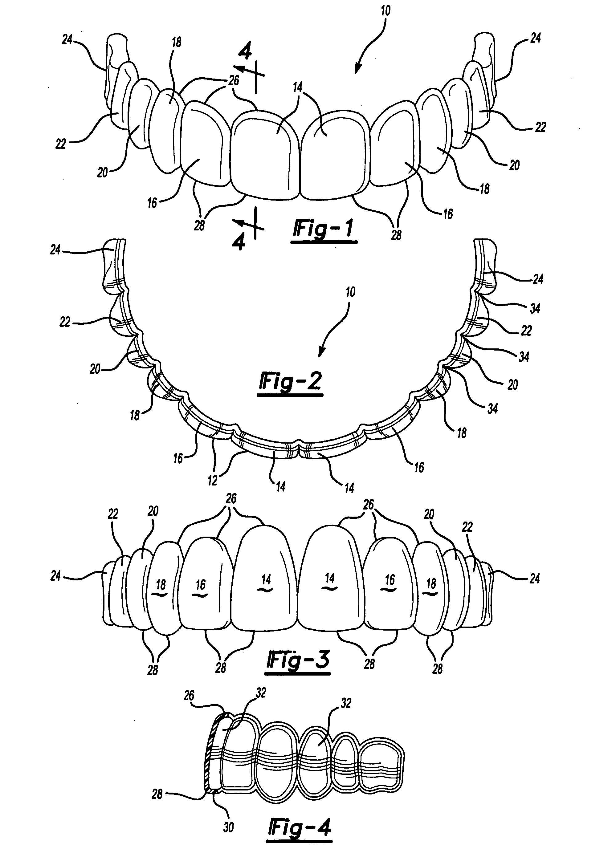 Dental template and method of visually demonstrating an overlay for a dental patient and setting the horizontal plane with an overlay