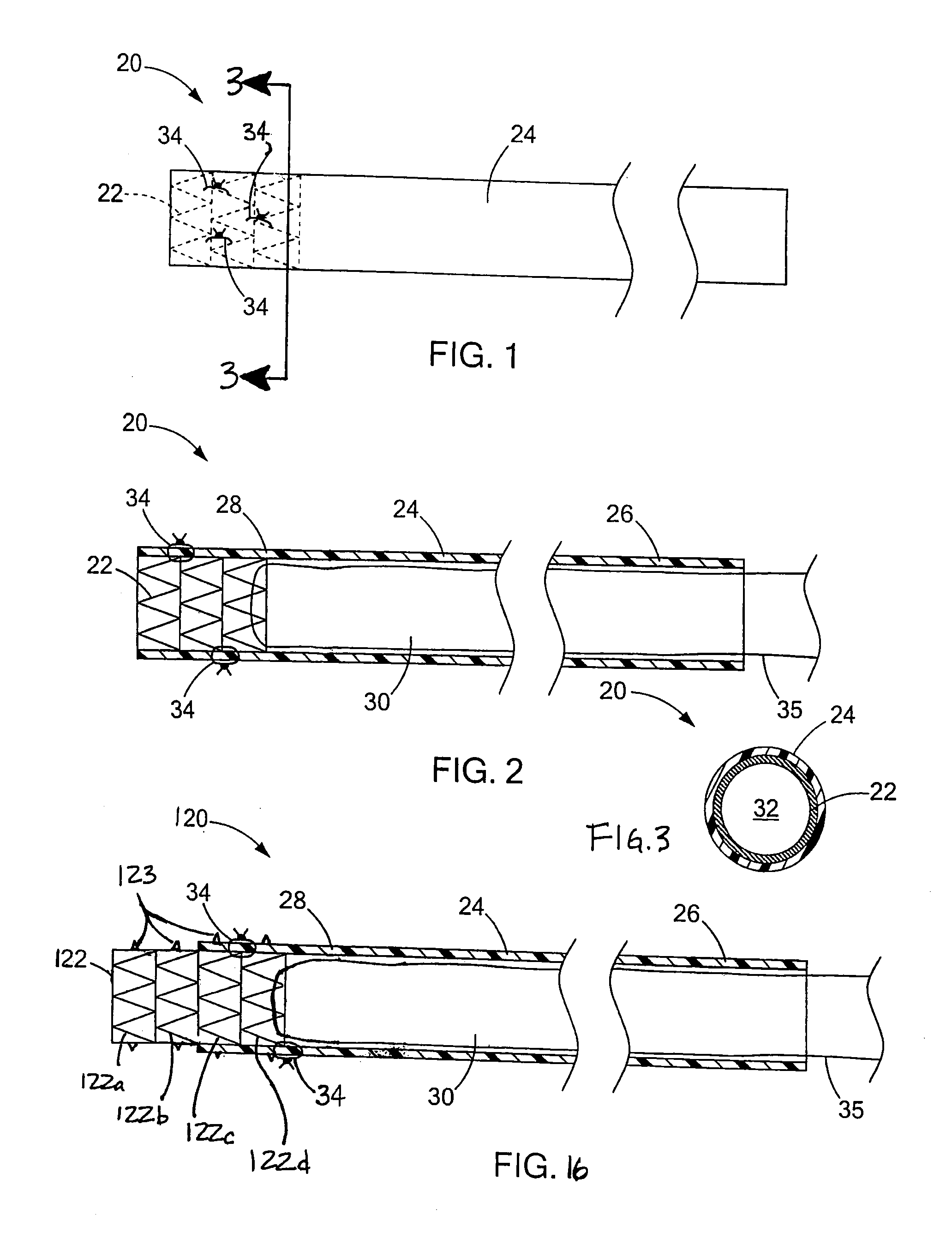 Systems, devices and methods for accessing a bodily opening