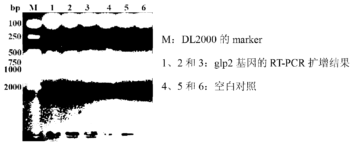 Construction method and application of recombinant lactobacillus acidophilus for expressing glucagon-like peptide-2