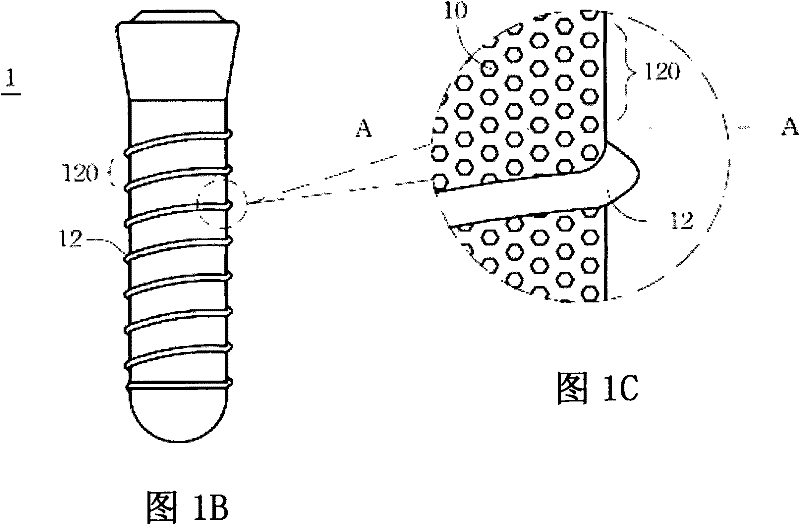 Threaded biomedical implant structure and selective surface treatment method thereof