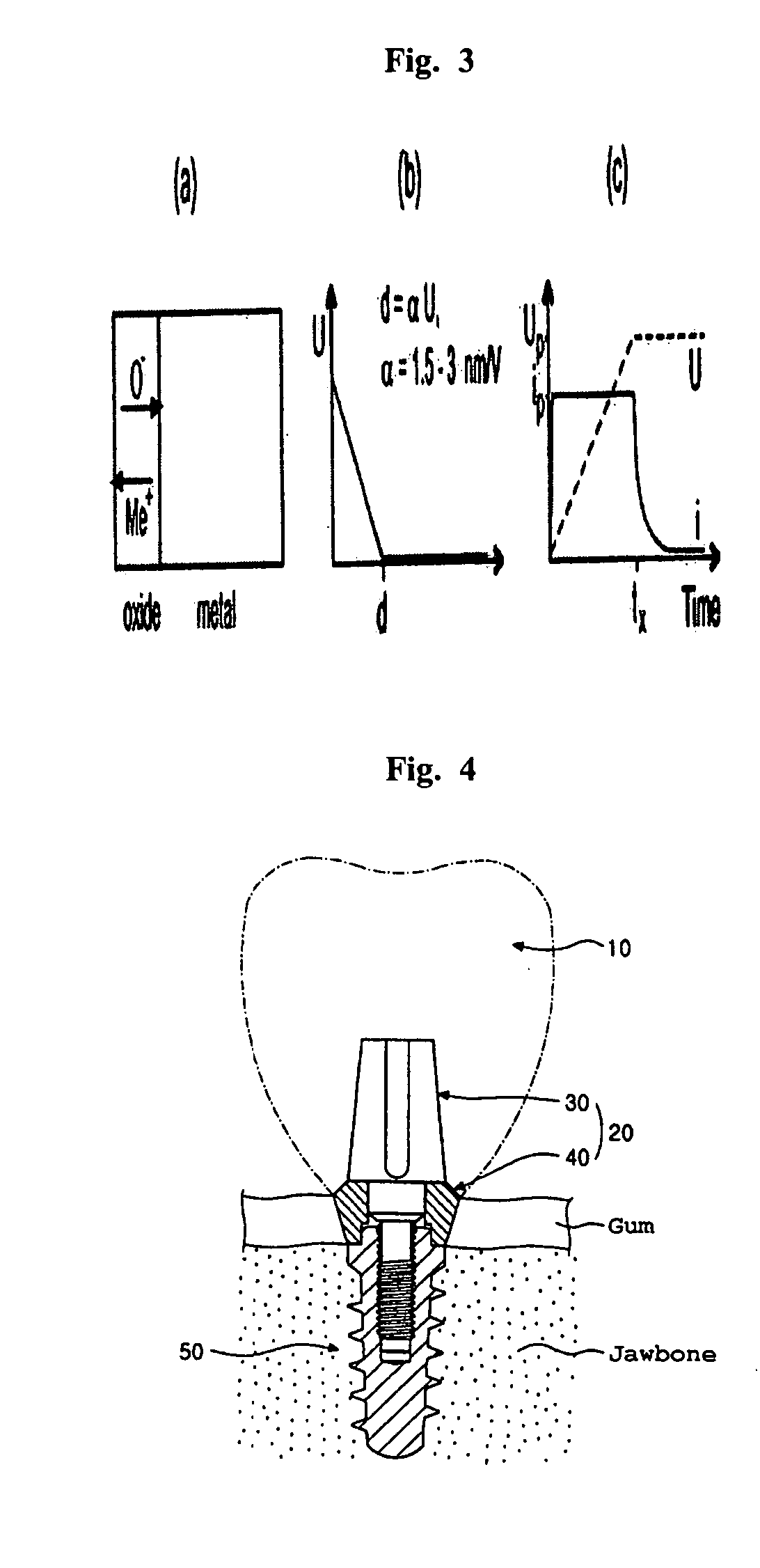 Abutment of dental implant and aesthetic surface treatment method of the same