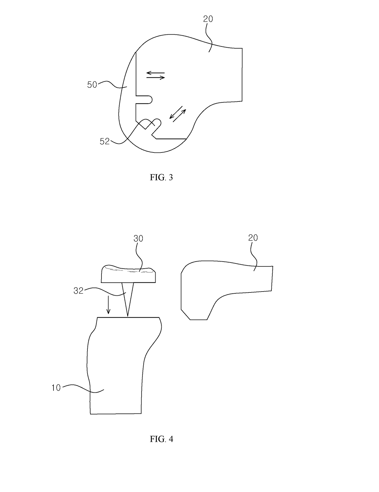 Knee joint implant