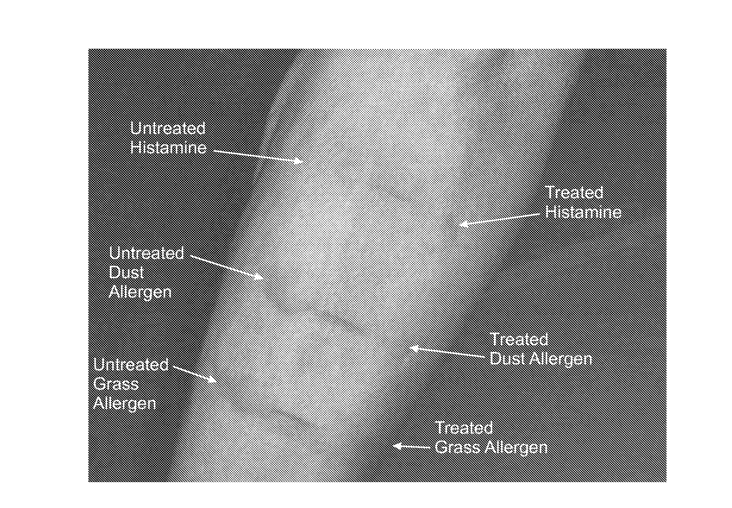 X-ray contrast media compositions and methods of using the same to treat, reduce or delay the onset of CNS inflammation and inflammation associated conditions