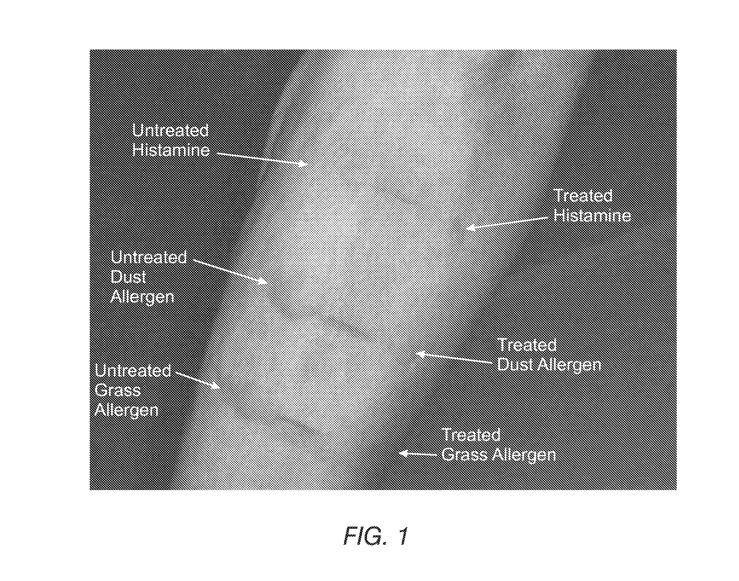 X-ray contrast media compositions and methods of using the same to treat, reduce or delay the onset of CNS inflammation and inflammation associated conditions