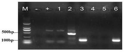 PCR identification method for kangfuxin solution
