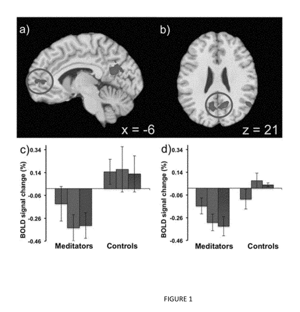 Method of correlating brain activity