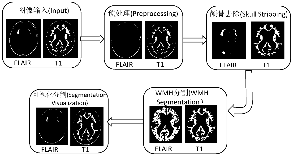 White matter hyperintensities automatic segmentation system and method based on Unet model
