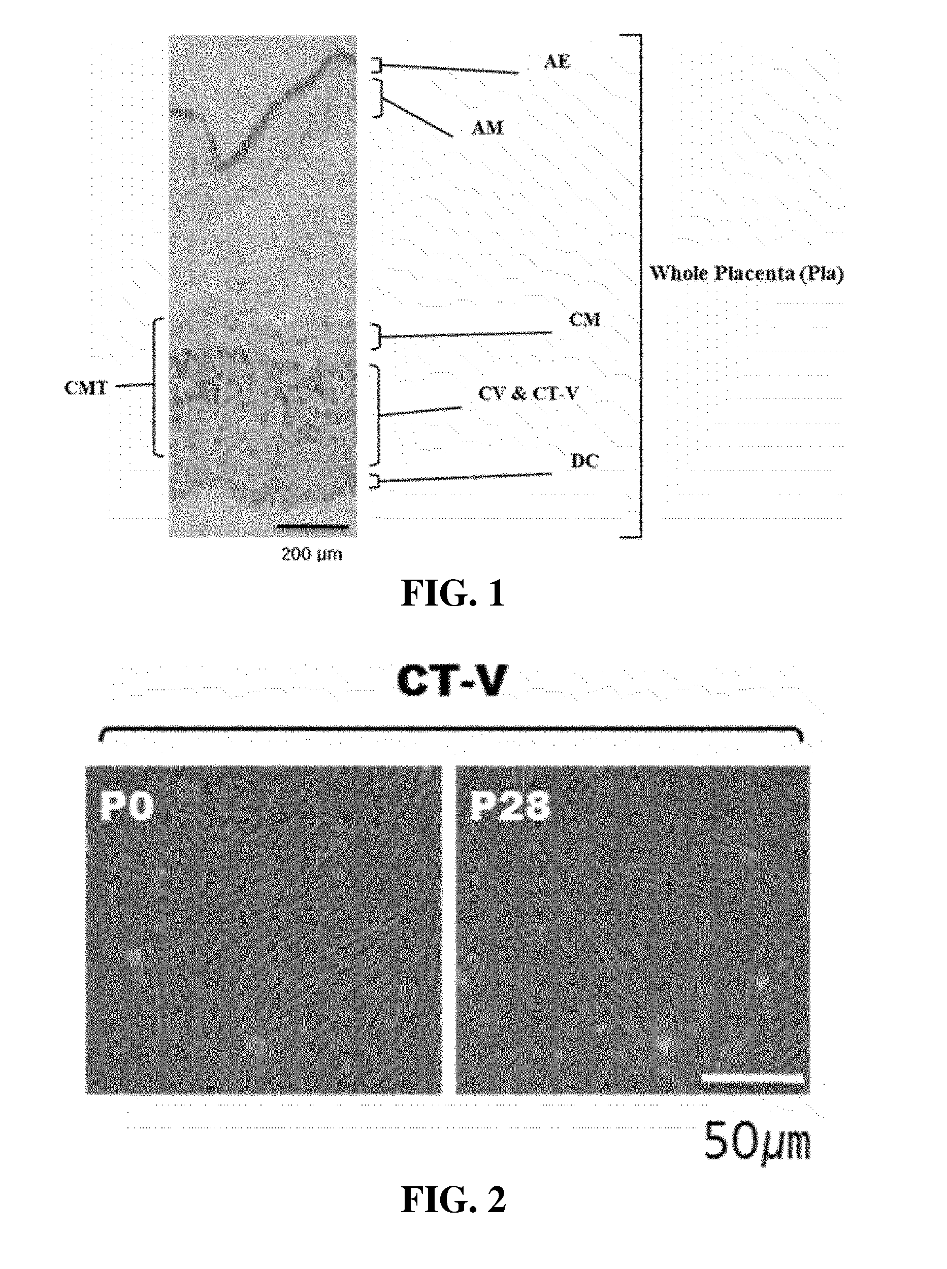 Stem Cells Derived from Pure Chorionic Trophoblast Layer and Cell Therapy Comprising Same