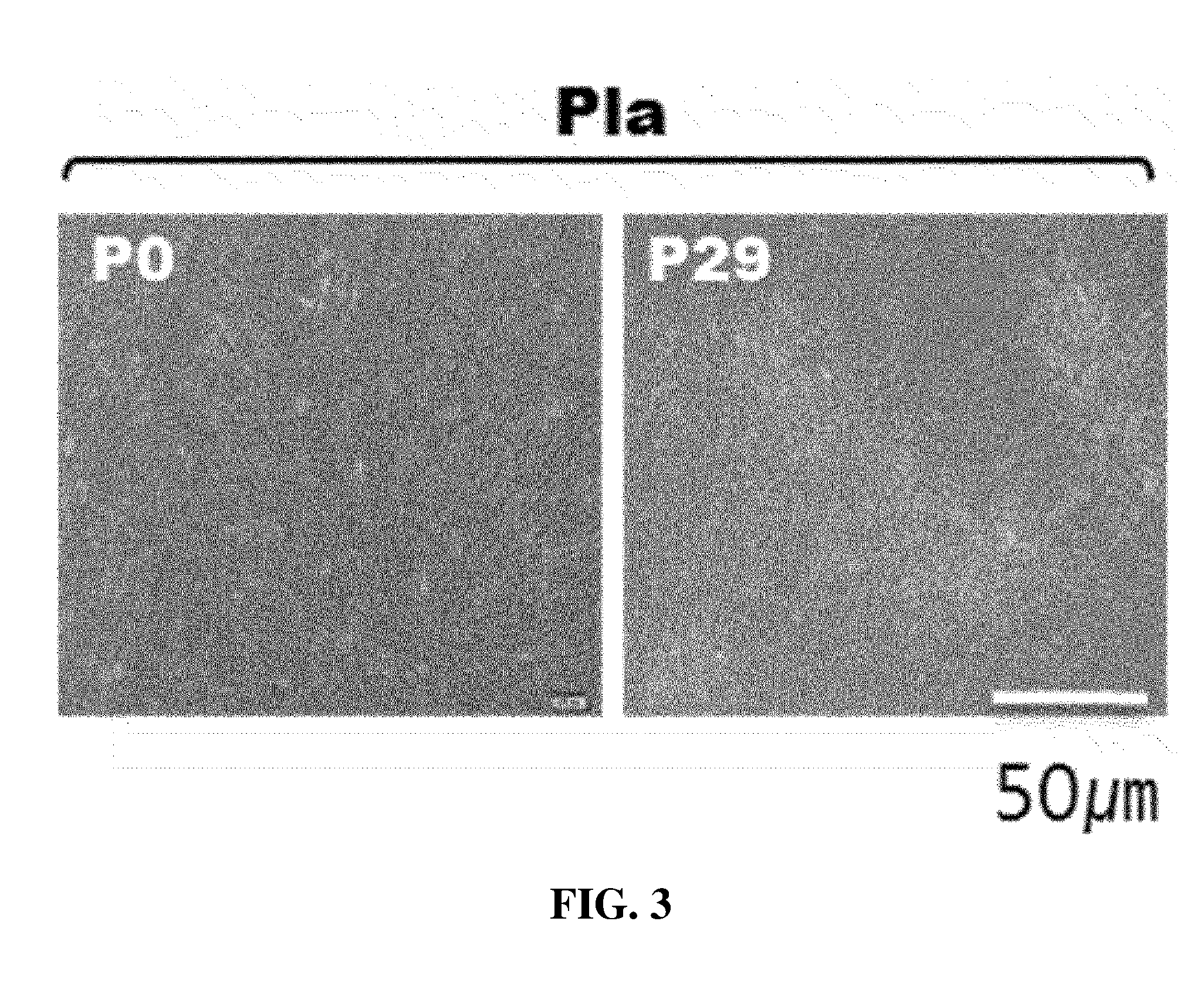 Stem Cells Derived from Pure Chorionic Trophoblast Layer and Cell Therapy Comprising Same