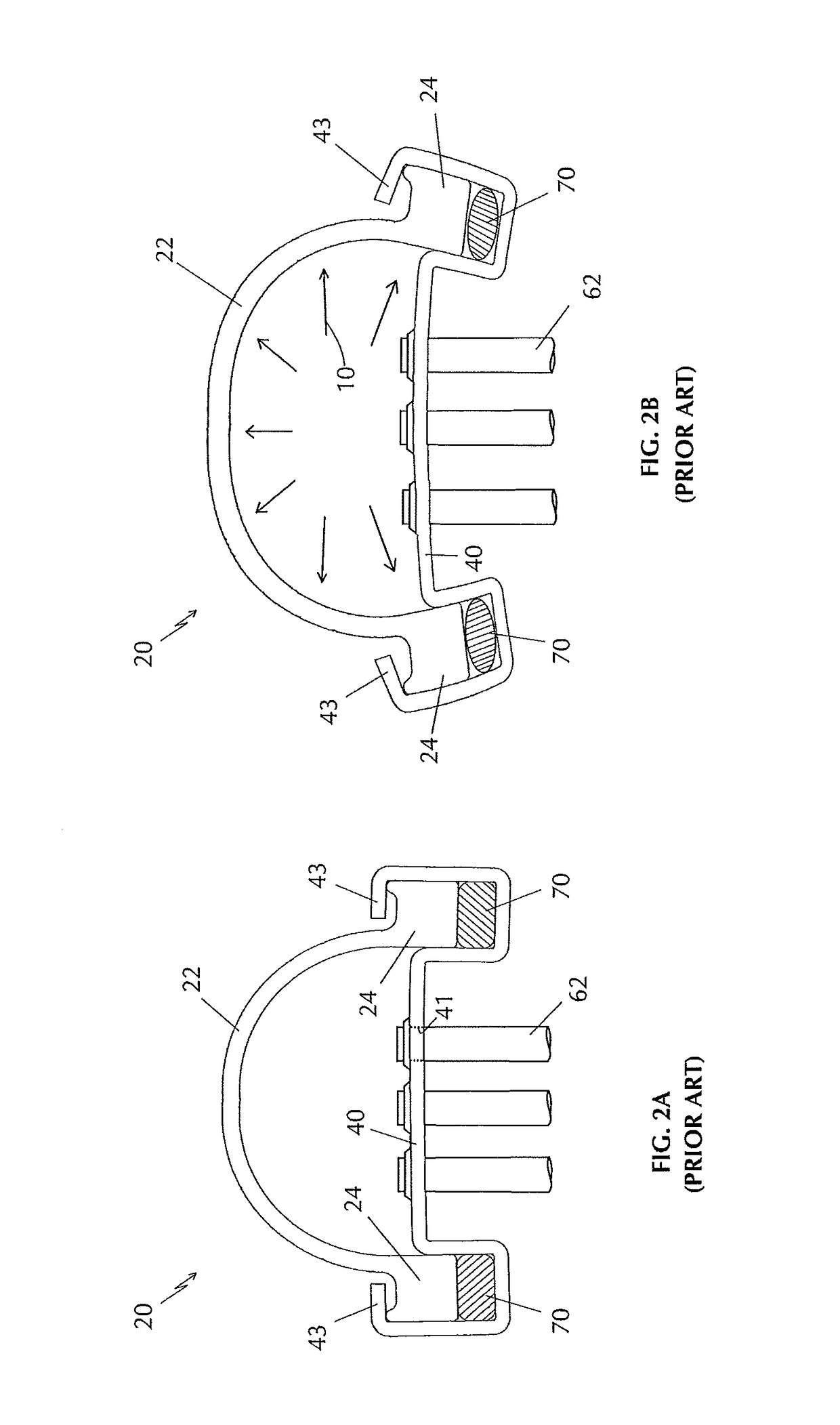 Radiator tank fastening system