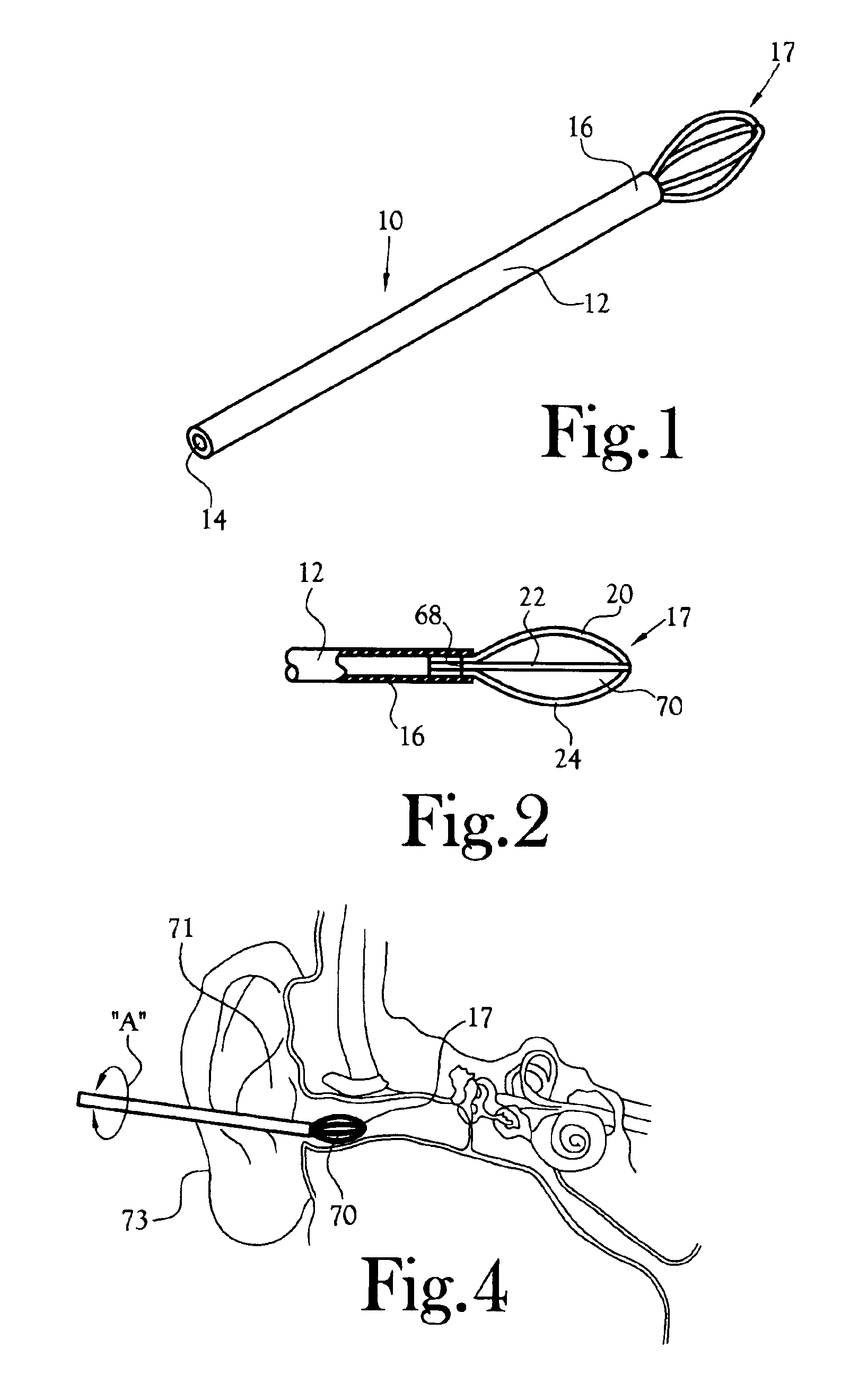 Ear cleaning appliance and method of manufacture